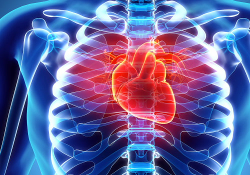 Understanding Cardiovascular Disease
